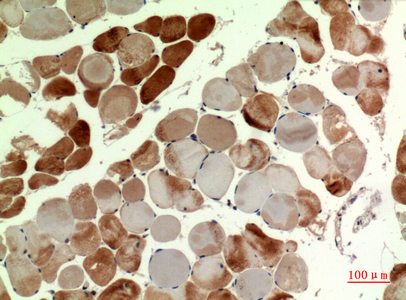 14 - MYH-pan Polyclonal Antibody AP73610