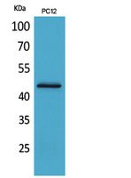 1 - IL-1RII Polyclonal Antibody AP73653