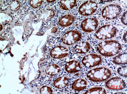 14 - IL-1RII Polyclonal Antibody AP73653