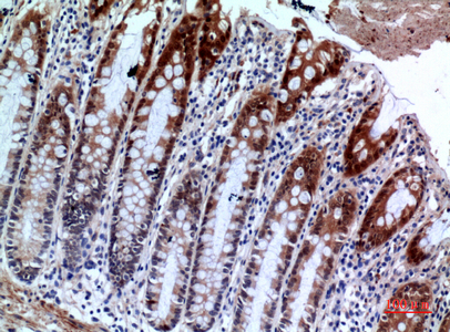 14 - IL-1RII Polyclonal Antibody AP73653