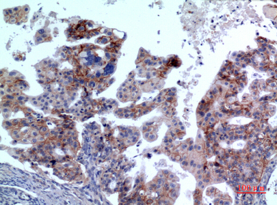 14 - IL-1RII Polyclonal Antibody AP73653
