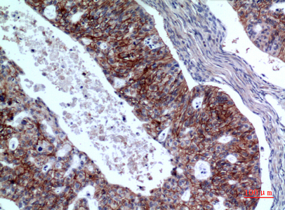 14 - IL-1RII Polyclonal Antibody AP73653