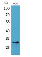 1 - HLA-DQB1/2 Polyclonal Antibody AP73675