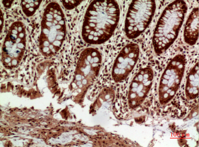 14 - HLA-DQB1/2 Polyclonal Antibody AP73675