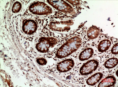 14 - HLA-DQB1/2 Polyclonal Antibody AP73675