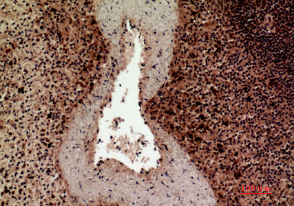 14 - HLA-DQB1/2 Polyclonal Antibody AP73675