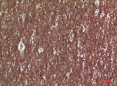 14 - COL5A2 Polyclonal Antibody AP73716
