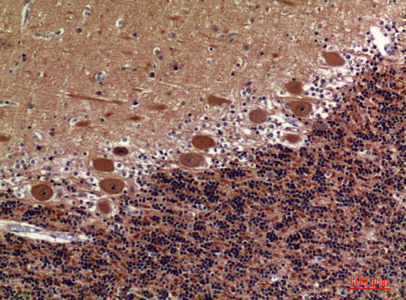 14 - COL5A2 Polyclonal Antibody AP73716