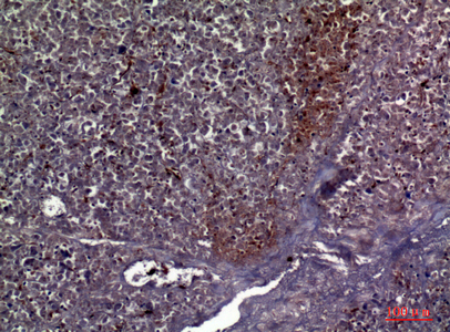 14 - COL5A2 Polyclonal Antibody AP73716