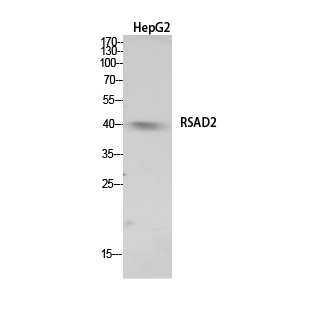 1 - RSAD2 Polyclonal Antibody AP73717