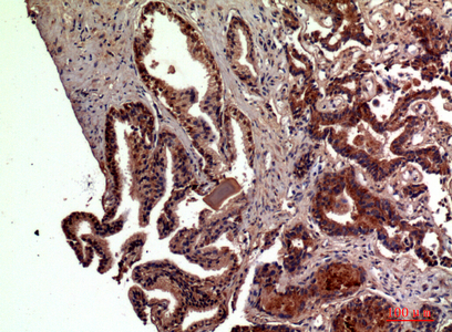 14 - RSAD2 Polyclonal Antibody AP73717