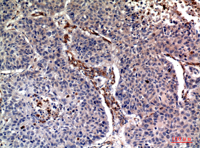 14 - Ub Polyclonal Antibody AP73724