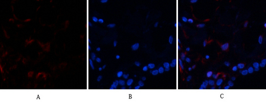 3 - Ub Polyclonal Antibody AP73724