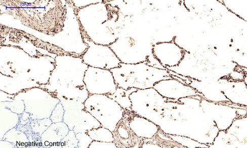 14 - Ub Polyclonal Antibody AP73724