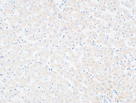 14 - C4a/b Polyclonal Antibody AP73725