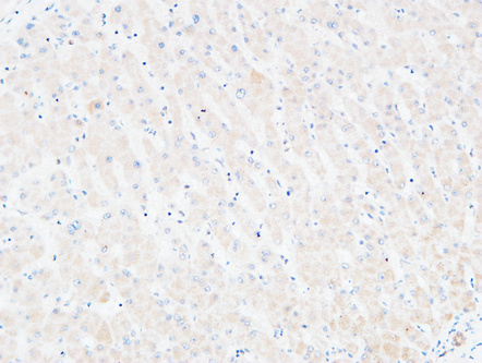 14 - C4a/b Polyclonal Antibody AP73725