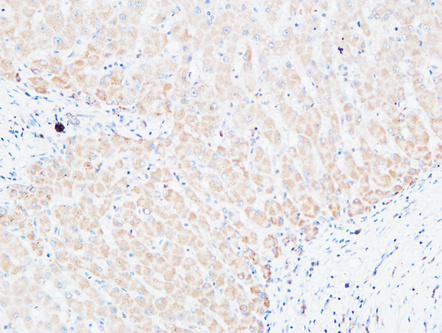 14 - C4a/b Polyclonal Antibody AP73725