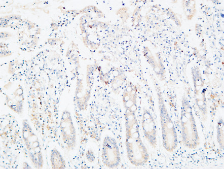 14 - C4a/b Polyclonal Antibody AP73725