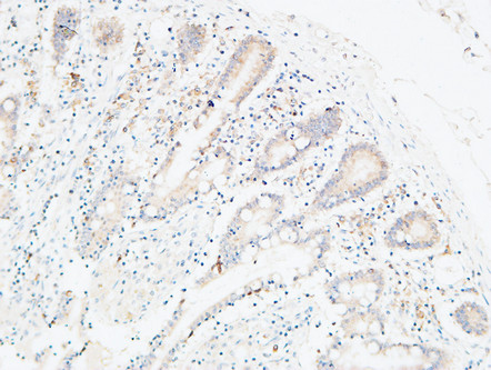 14 - C4a/b Polyclonal Antibody AP73725