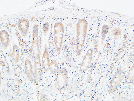 14 - C4a/b Polyclonal Antibody AP73725