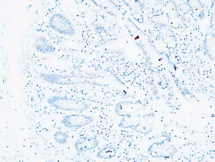 14 - C4a/b Polyclonal Antibody AP73725