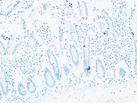 14 - C4a/b Polyclonal Antibody AP73725