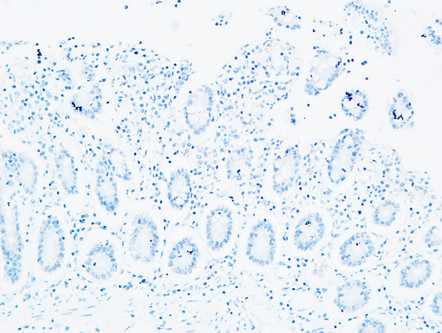 14 - C4a/b Polyclonal Antibody AP73725