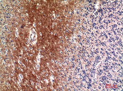 14 - C4a/b Polyclonal Antibody AP73725