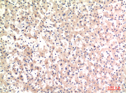 14 - C4a/b Polyclonal Antibody AP73725