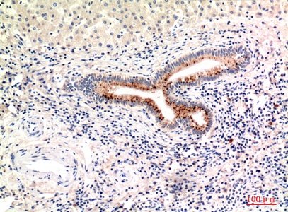 14 - C4a/b Polyclonal Antibody AP73725