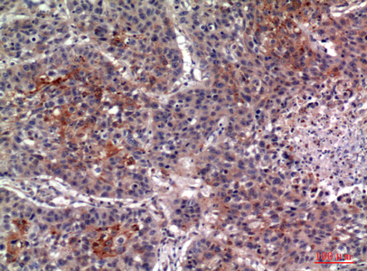 14 - IL-13Rα2 Polyclonal Antibody AP73799