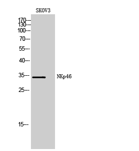 1 - NKp46 Polyclonal Antibody AP73804