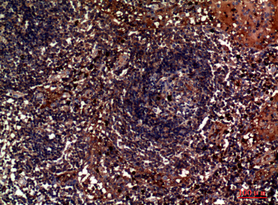 14 - Lambda 5 Polyclonal Antibody AP73824