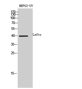 1 - Lefty Polyclonal Antibody AP73830