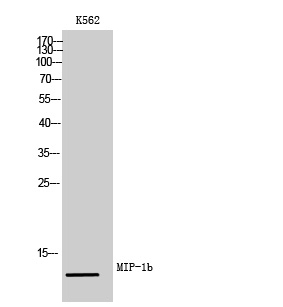 1 - MIP-1b Polyclonal Antibody AP73835
