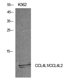 1 - MIP-1b Polyclonal Antibody AP73835