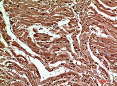 14 - Dectin-2 Polyclonal Antibody AP73868