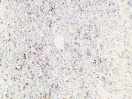 14 - CD72 Polyclonal Antibody AP73892