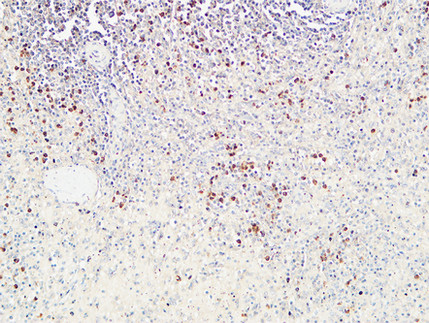 14 - CD72 Polyclonal Antibody AP73892