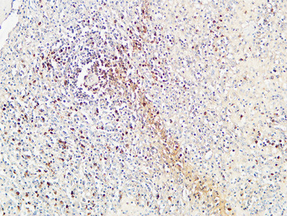 14 - CD72 Polyclonal Antibody AP73892