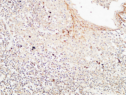 14 - CD72 Polyclonal Antibody AP73892