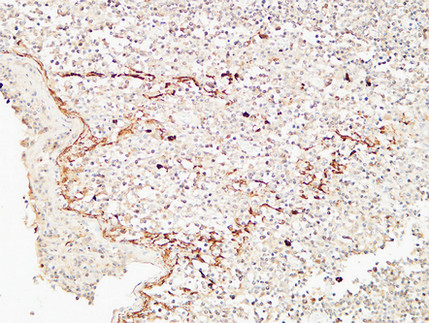 14 - CD72 Polyclonal Antibody AP73892