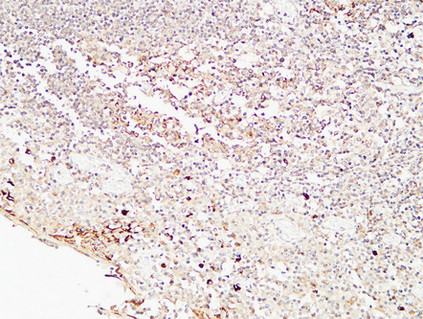 14 - CD72 Polyclonal Antibody AP73892