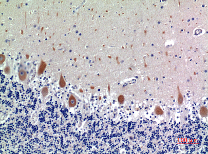 14 - CD158e Polyclonal Antibody AP73899