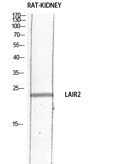 1 - CD306 Polyclonal Antibody AP73901