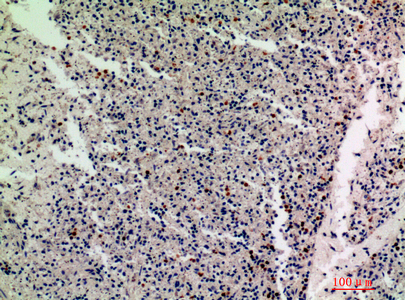 14 - IL-1F10 Polyclonal Antibody AP73908