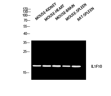 1 - IL-1F10 Polyclonal Antibody AP73908