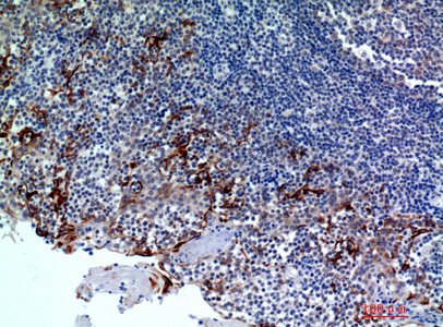 14 - CMTM8 Polyclonal Antibody AP73911