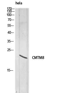 1 - CMTM8 Polyclonal Antibody AP73911