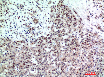 14 - TP53INP2 Polyclonal Antibody AP73916